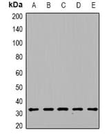 Polyclonal Rabbit anti-Human DGUOK / Deoxyguanosine Kinase Antibody (WB)