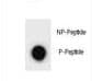 ULK2 Antibody (phospho-Ser323)