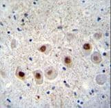 COAA / RBM14 Antibody (aa563-594)