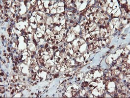 SERPINB1 Antibody (clone OTI3B4)