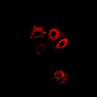 P5CDH / ALDH4A1 Antibody