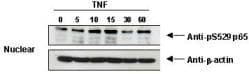 RELA / NFKB p65 Antibody (phospho-Ser276)