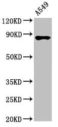 IKBKB / IKK2 / IKK Beta Antibody