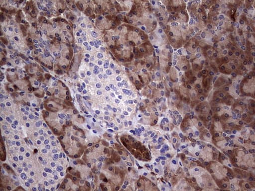 LGALS3 / Galectin 3 Antibody (clone OTI7G9)