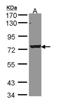 STKLD1 / SgK071 Antibody (aa438-614)