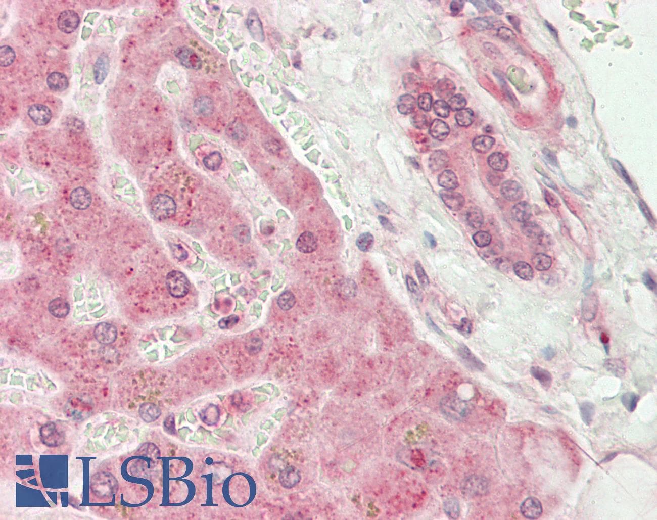 Polyclonal Rabbit anti-Human PYCR1 Antibody (C-Terminus, IHC, WB)