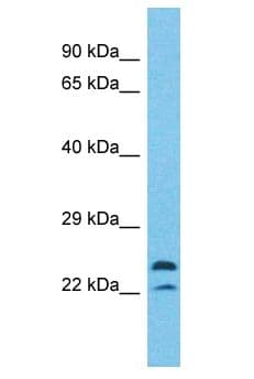MAPK1IP1L Antibody (aa2-51)