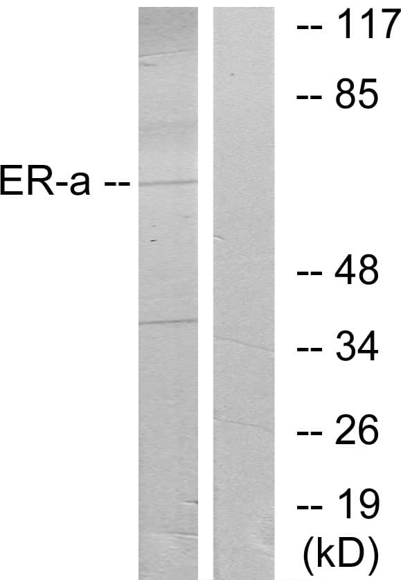 ER Alpha / Estrogen Receptor Antibody (aa71-120)