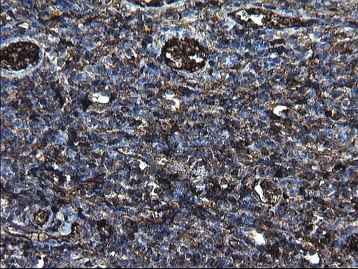 FGG / Fibrinogen Gamma Antibody (clone OTI2D2)