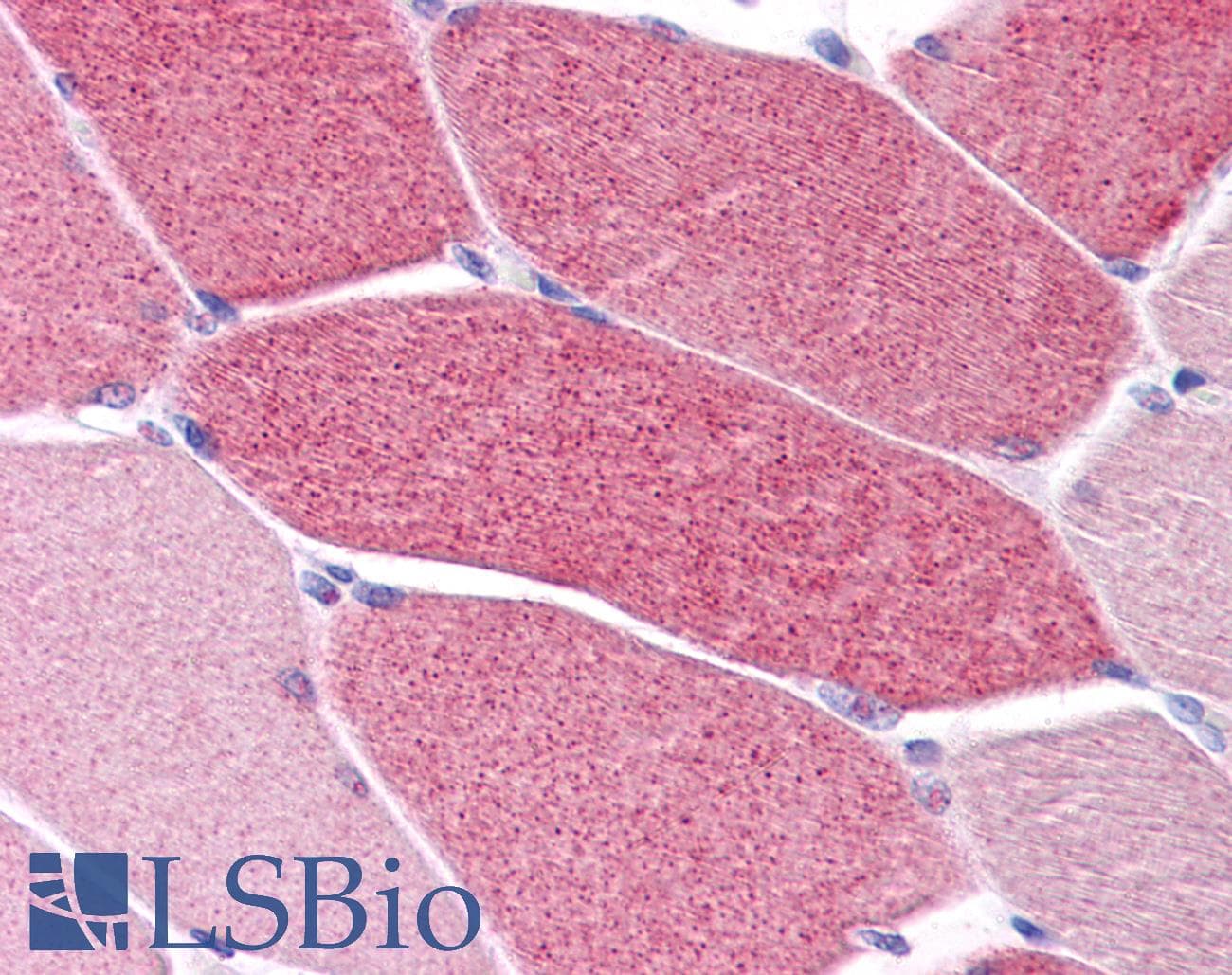 IHC-plus™ Polyclonal Rabbit anti-Human LRRC19 Antibody (IHC, IF, WB)