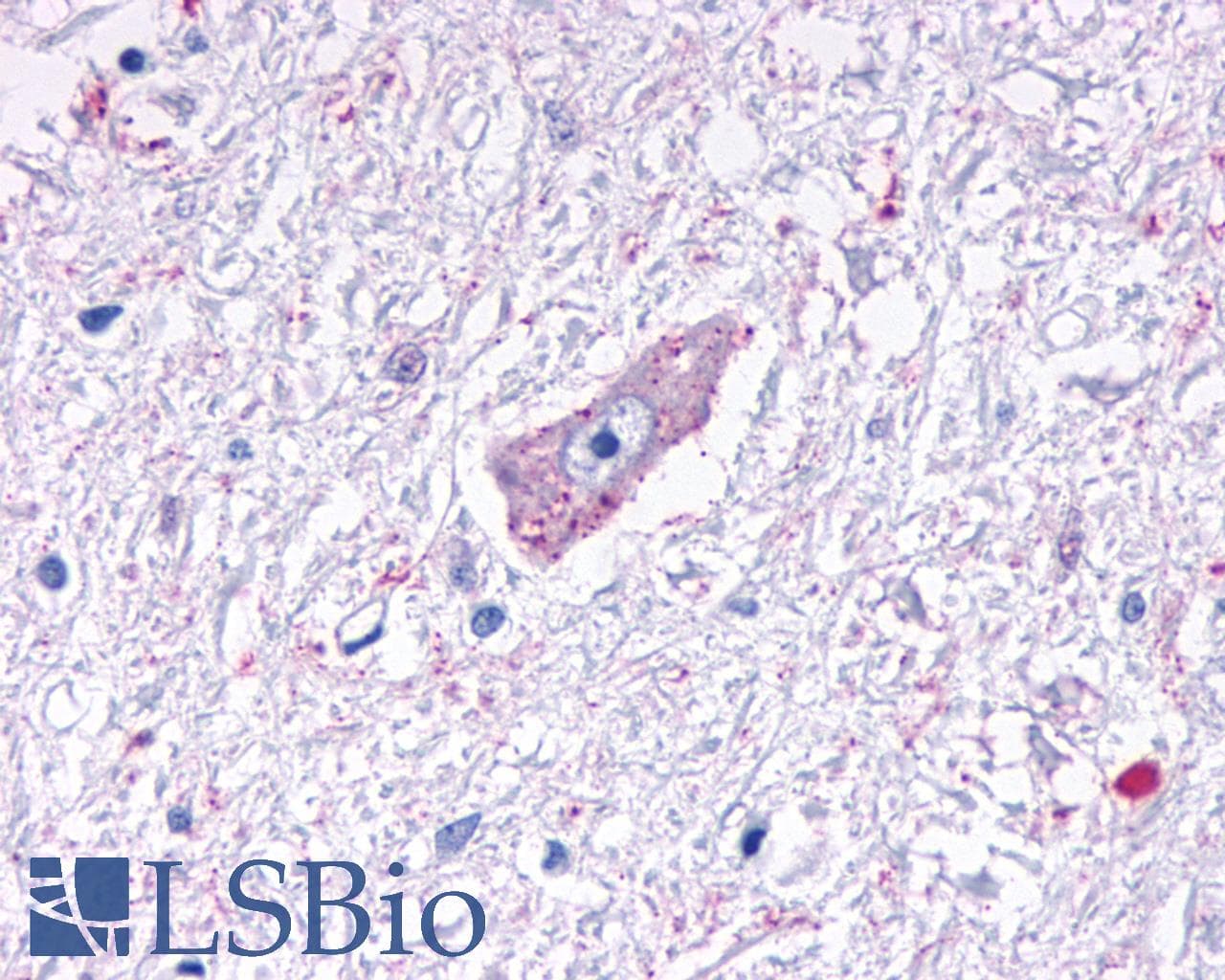 PathPlus™ MRGD / MRGPRD Antibody (Cytoplasmic Domain)