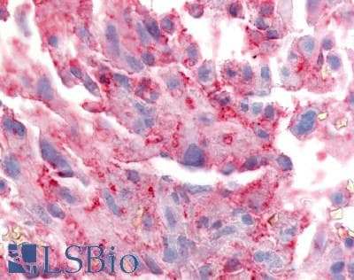 PathPlus™ Polyclonal Rabbit anti-Human TRPA1 Antibody (Internal, IHC, IF)