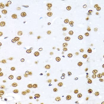 KHDRBS1 / SAM68 Antibody