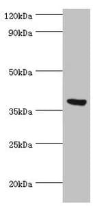 FKBP4 / FKBP52 Antibody (aa220-459)