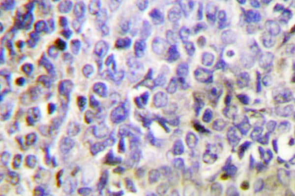 GZMK / Granzyme K Antibody (His85)