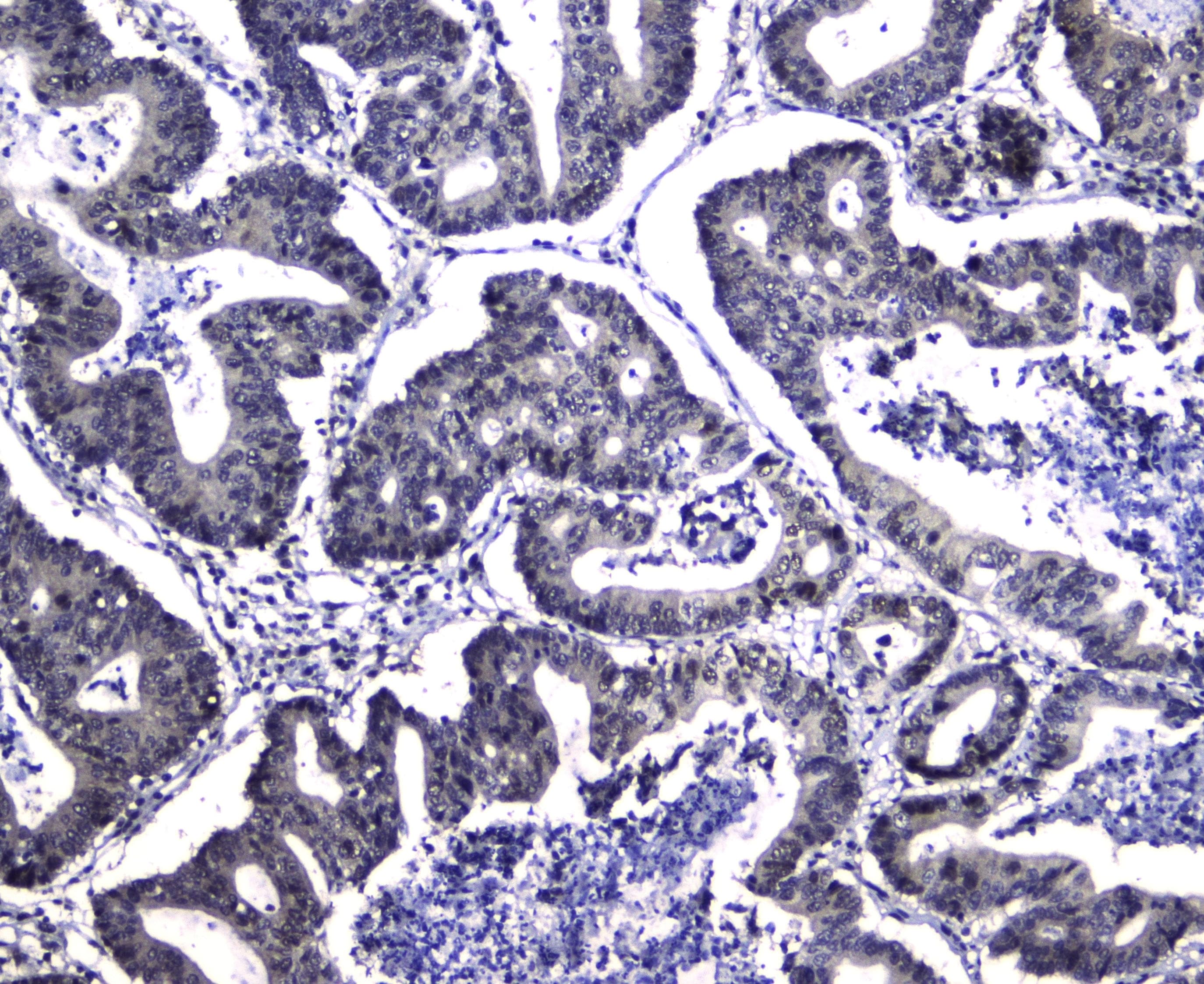 DCK / Deoxycytidine kinase Antibody