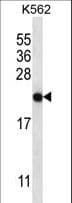 CHAC2 Antibody (aa61-89)