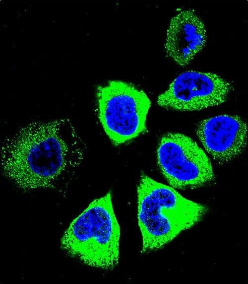 TUBB8P12 / Tubulin beta-8 Antibody (aa 253-280, C-term)