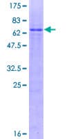 Human ZFPL1 Protein (Recombinant GST)