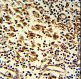 ARHGAP45 Antibody (aa877-903)