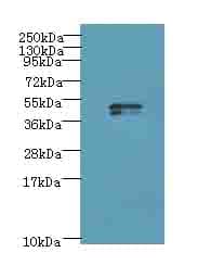 Polyclonal Rabbit anti-Human KRT35 / Keratin 35 / KRTHA5 Antibody (aa1-455, IHC, WB)