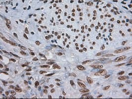 NOTCH1 Antibody (clone OTI4C9)