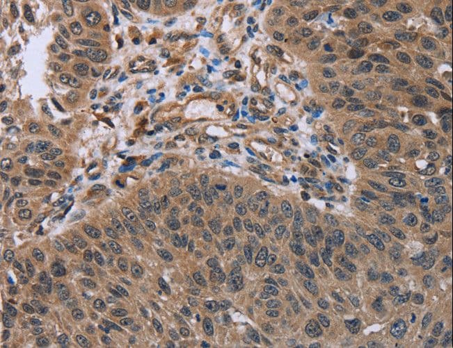 HOMER1 / Homer 1 Antibody