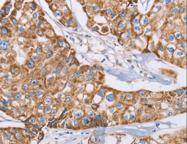 GUCY1A1 / GUCY1A3 Antibody