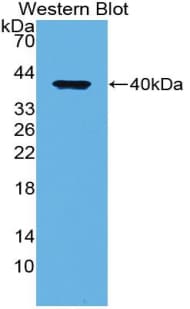 LRP1 / CD91 Antibody (aa337-426)