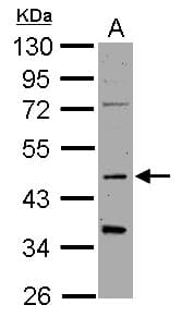 PathPlus™ Polyclonal Rabbit anti-Human SYT1 / Synaptotagmin Antibody (IHC, IF, WB)