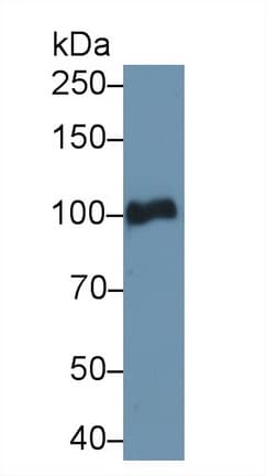 PLG / Plasmin / Plasminogen Antibody (aa582-812)