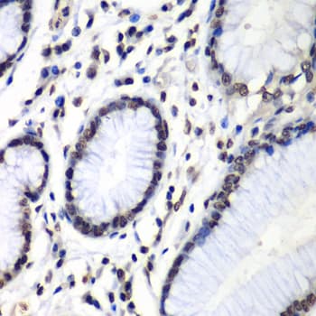 HNRPM / HNRNPM Antibody
