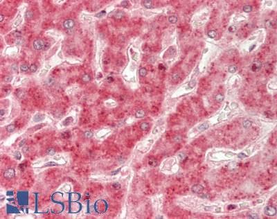 IHC-plus™ Polyclonal Rabbit anti-Human VTI1A Antibody (IHC, WB)