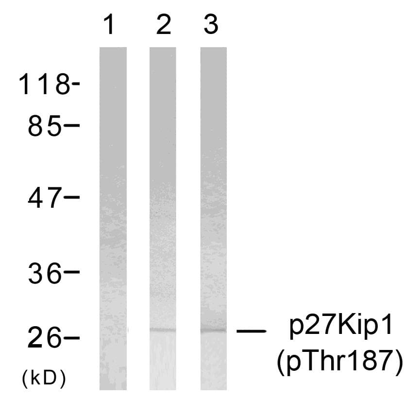 CDKN1B / p27 Kip1 Antibody (phospho-Thr187)