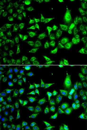 Polyclonal Rabbit anti-Human ACCS / ACS Antibody (IHC, IF, WB)
