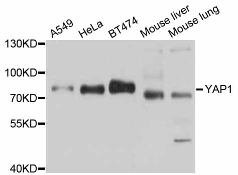 YAP / YAP1 Antibody