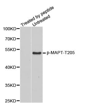 MAPT / Tau Antibody (phospho-Thr205)