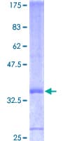 Human FGF7 / KGF Protein (Recombinant GST)