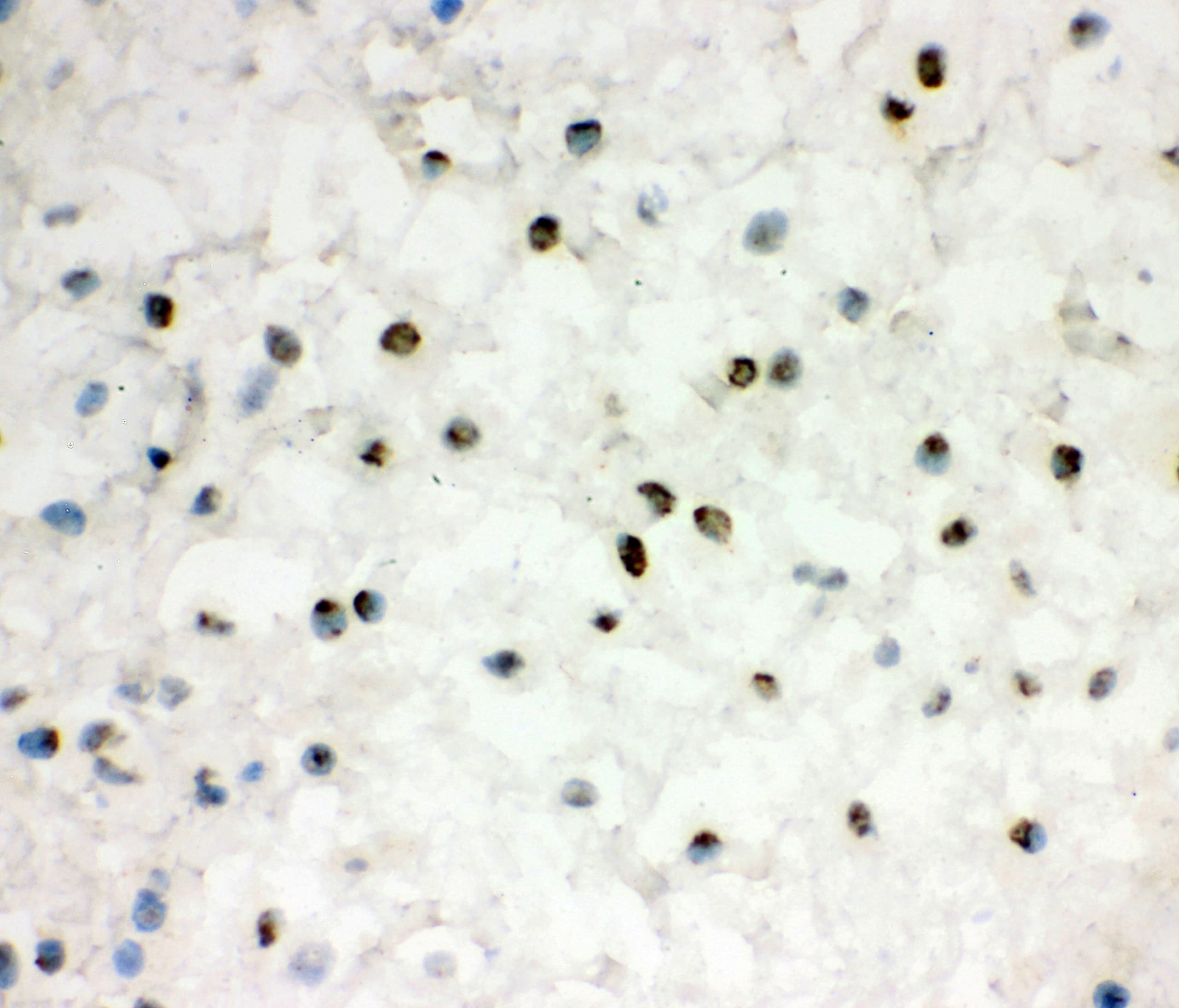 EWSR1 / EWS Antibody (aa369-399)