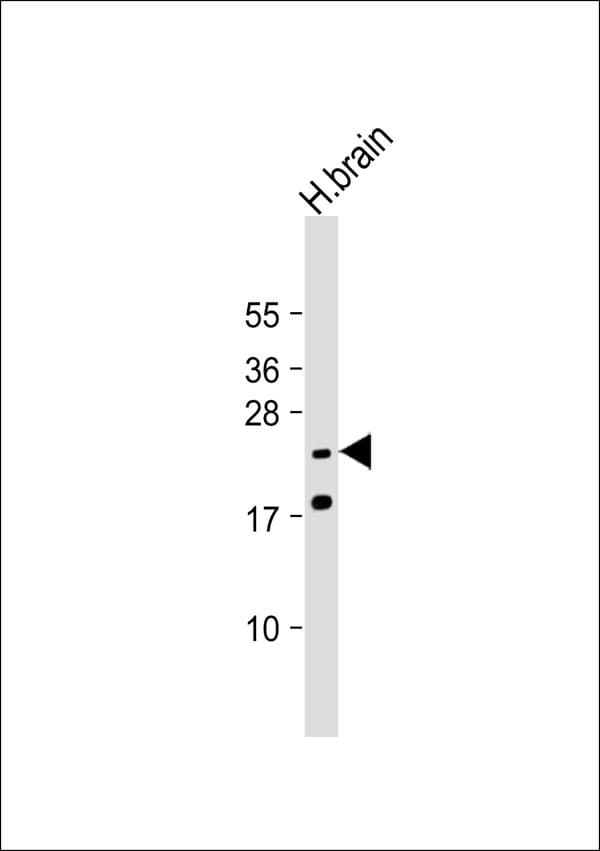 SCN4B Antibody