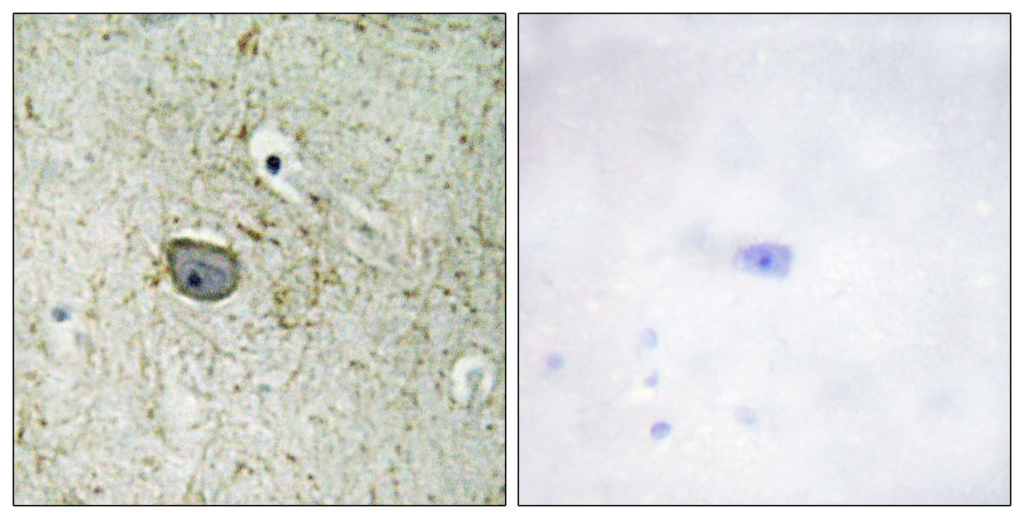 Polyclonal Rabbit anti-Human PDGFRA / PDGFR Alpha Antibody (aa731-780, IHC, IF)
