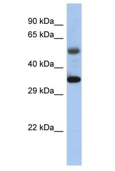 MTERF1 Antibody (aa212-261)