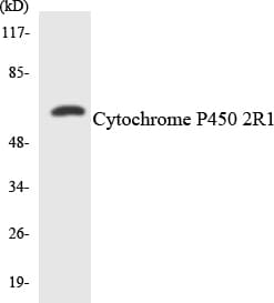 IHC-plus™ Polyclonal Rabbit anti-Human Cytochrome P450 2R1 / CYP2R1 Antibody (aa230-279, IHC, WB)
