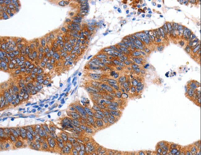 KCNC2 / Kv3.2 Antibody