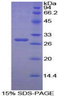 Human PPIE / Cyclophilin E Protein (Recombinant His-T7)