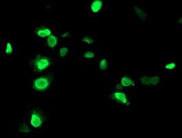 UNG / Uracil DNA Glycosylase Antibody (clone OTI2C12)