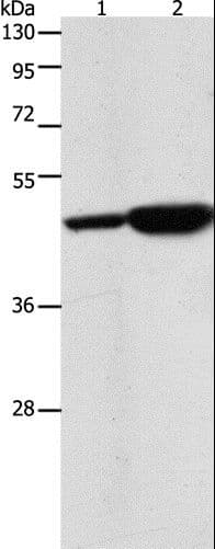 ENO2 / NSE Antibody