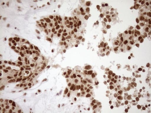 EXOSC1 / CSL4 Antibody (clone OTI1H9)