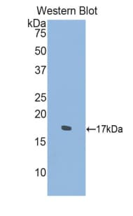 SEMA4D / Semaphorin 4D / CD100 Antibody (aa502-636, Biotin)