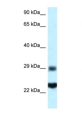 RPS9 / Ribosomal Protein S9 Antibody (C-Terminus)